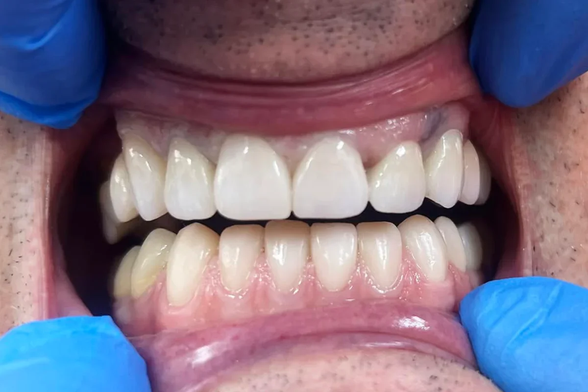 BL Dental - dr Bastašić Stomatološka ordinacija