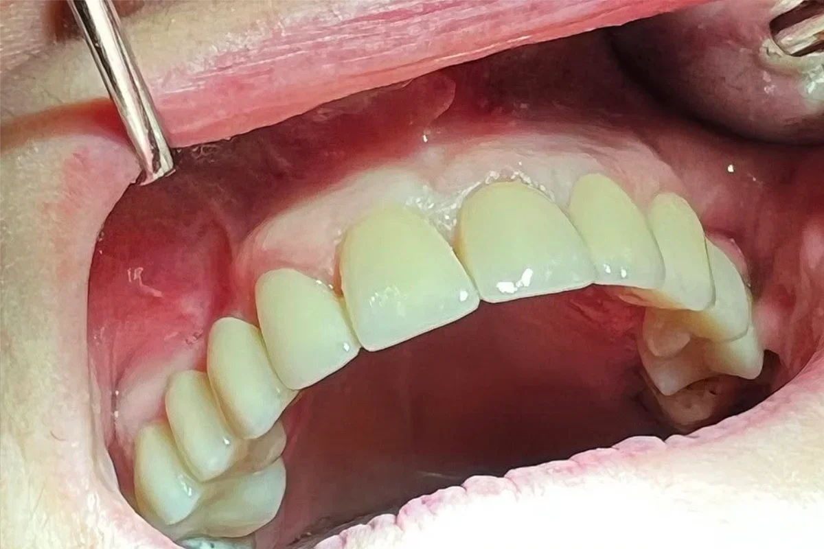 BL Dental - dr Bastašić Stomatološka ordinacija