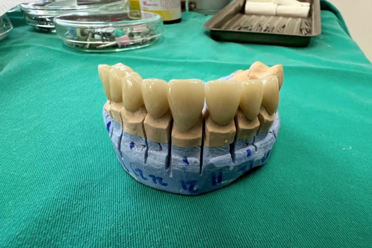 BL Dental - dr Bastašić Stomatološka ordinacija