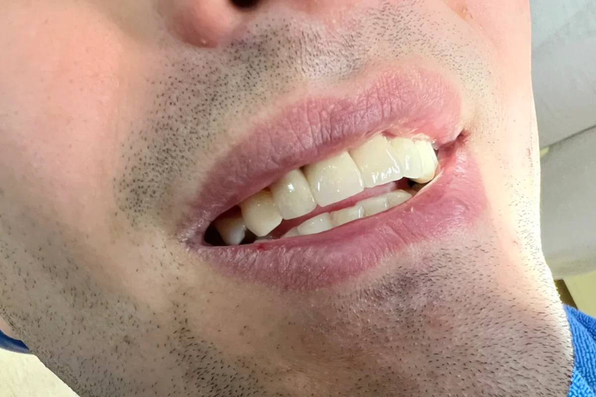 BL Dental - dr Bastašić Stomatološka ordinacija