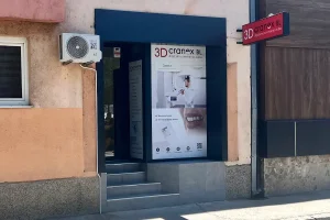 Cranex BL - 3D snimanje zuba Banja Luka